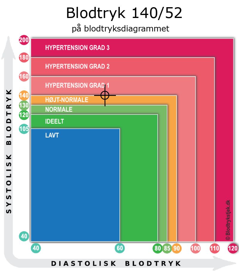 Blodtryk 140 over 52 i blodtryksdiagram