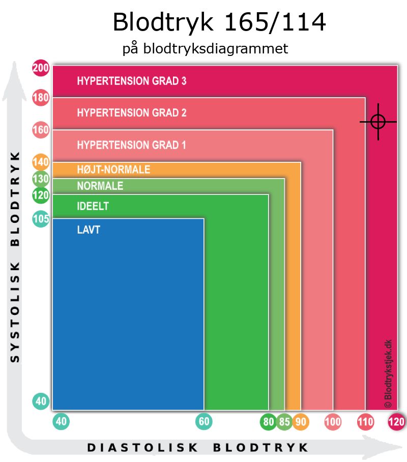 Blodtryk 165 over 114 i blodtryksdiagram
