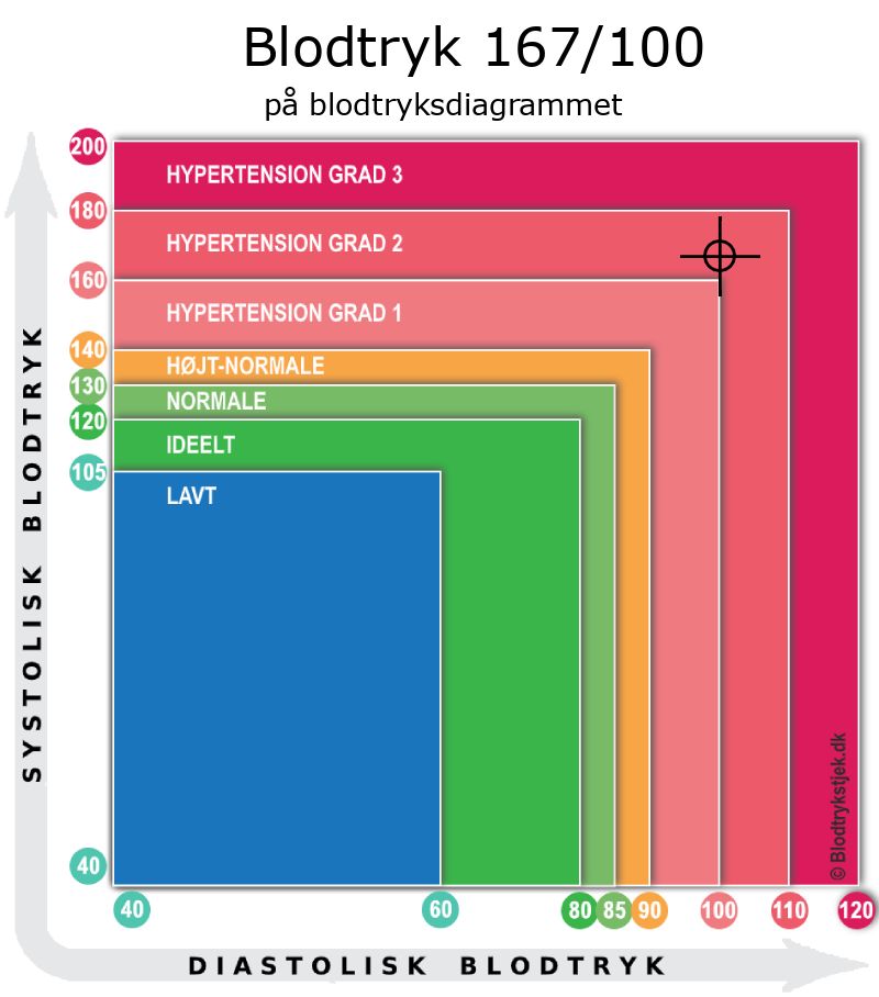 Blodtryk 167 over 100 i blodtryksdiagram
