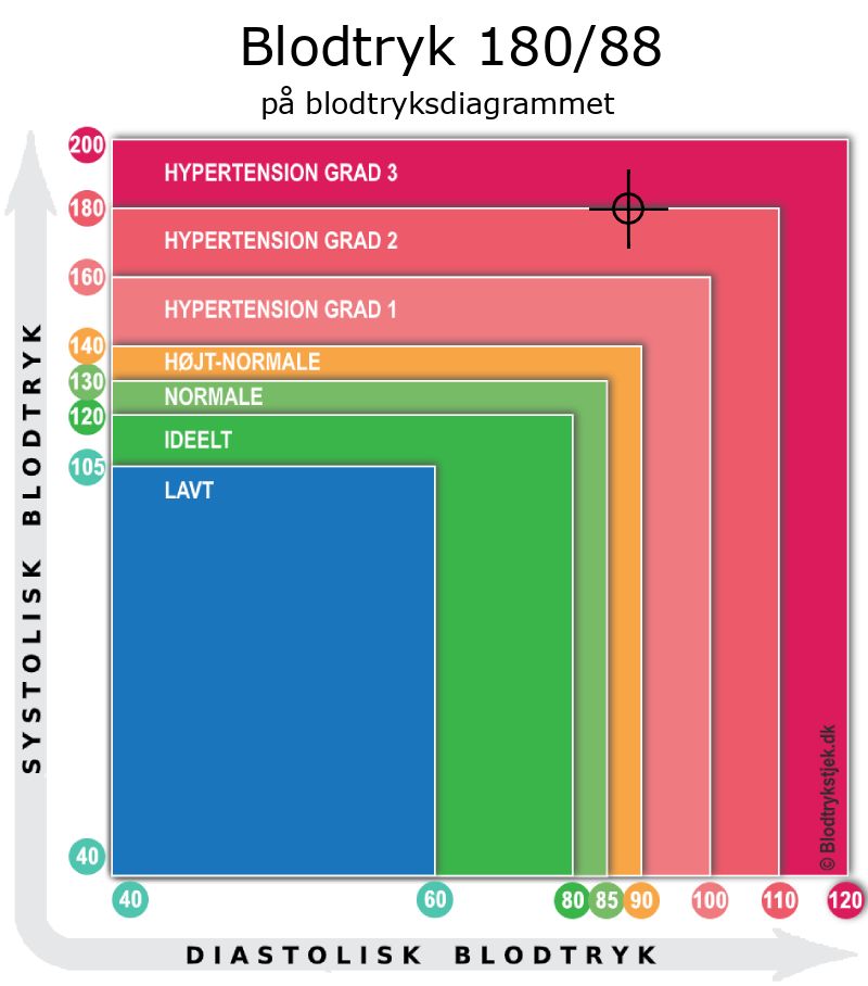 Blodtryk 180 over 88 i blodtryksdiagram