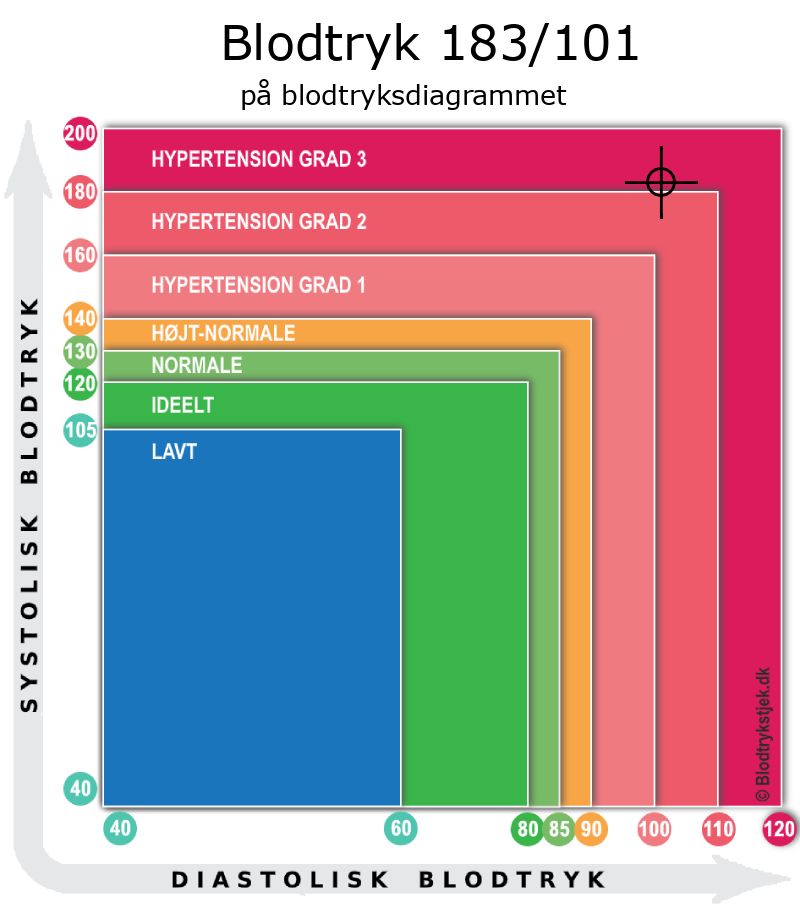 Blodtryk 183 over 101 i blodtryksdiagram
