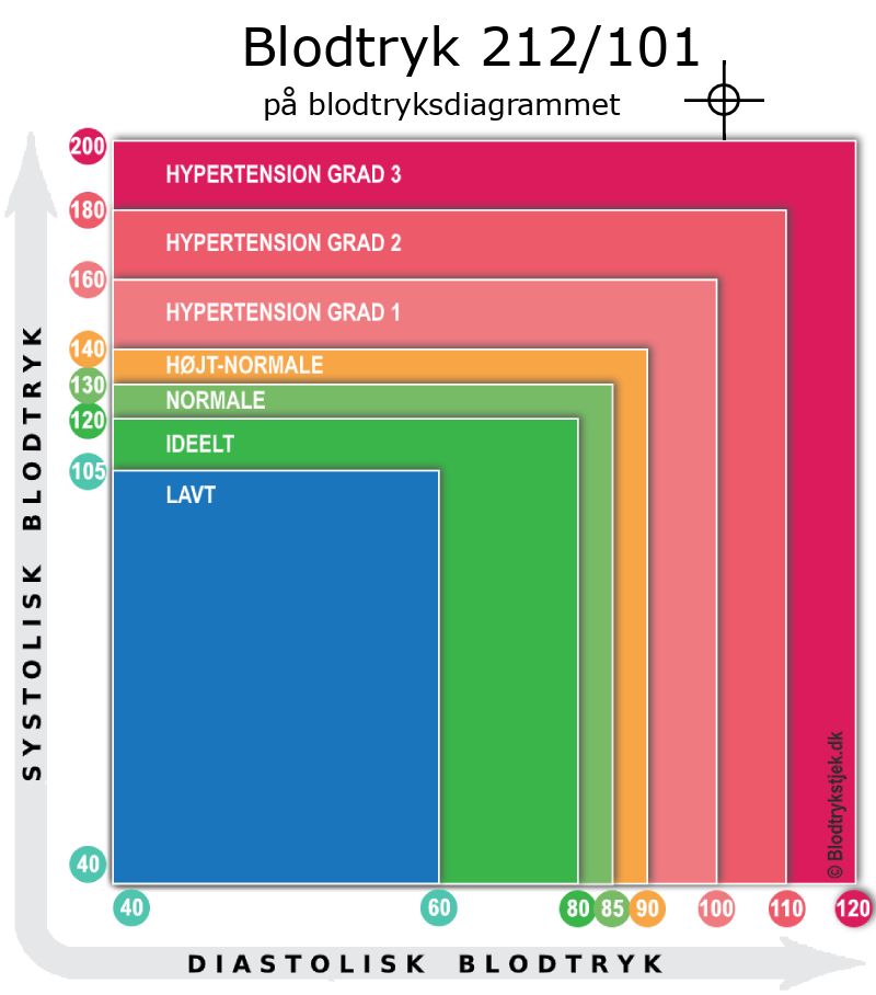 Blodtryk 212 over 101 i blodtryksdiagram