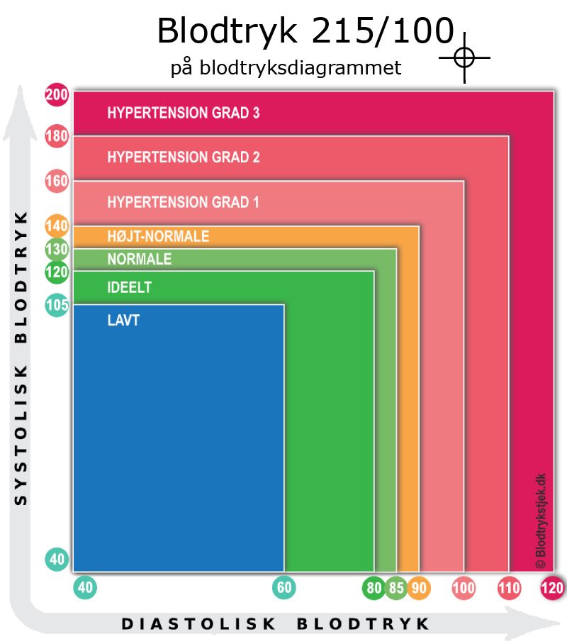 Blodtryk 215 over 100 i blodtryksdiagram